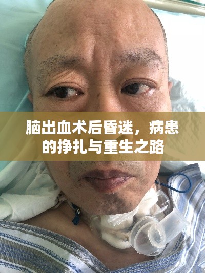 脑出血术后昏迷，病患的挣扎与重生之路