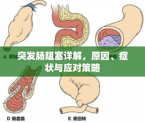 突发肠阻塞详解，原因、症状与应对策略