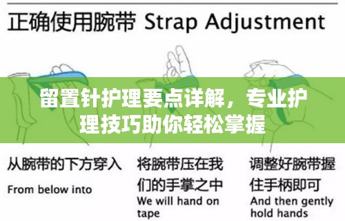 留置针护理要点详解，专业护理技巧助你轻松掌握