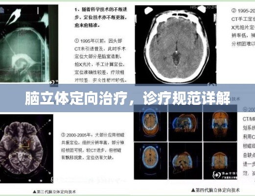 脑立体定向治疗，诊疗规范详解