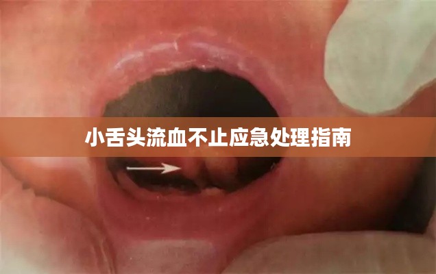 小舌头流血不止应急处理指南